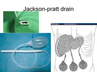 Jackson-pratt drain 
