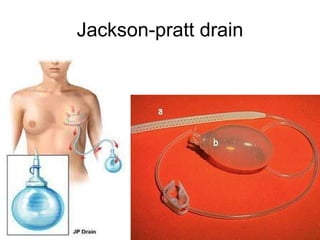 Jackson-pratt drain 