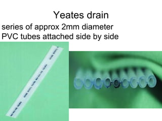 Yeates drain series of approx 2mm diameter  PVC tubes attached side by side 