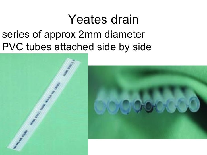 types of drains