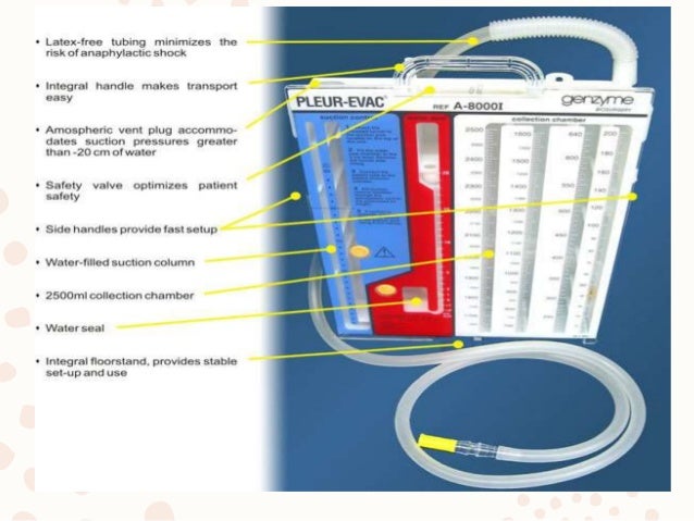 lung drainage system pleural Drainage cavity of lung drainage system pleural Drainage cavity of