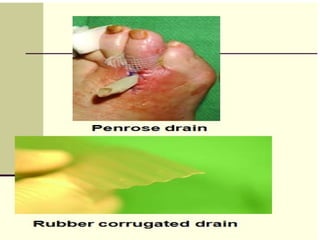 DRAINS,CATHETERS & SUTURES [Autosaved].ppt