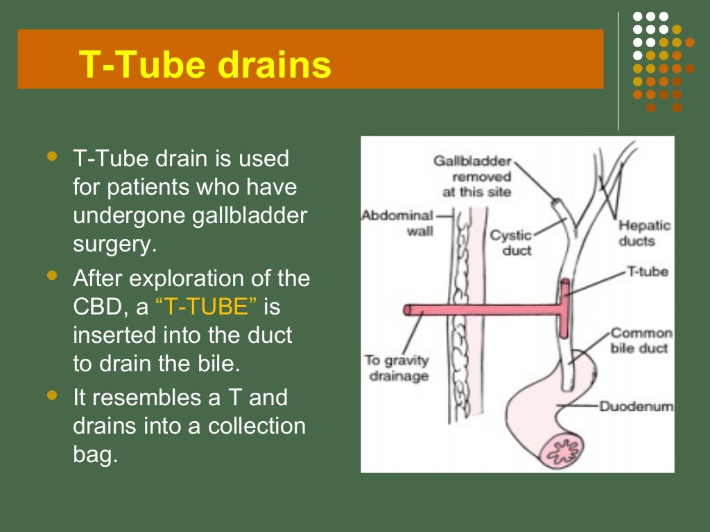 Drains in surgery