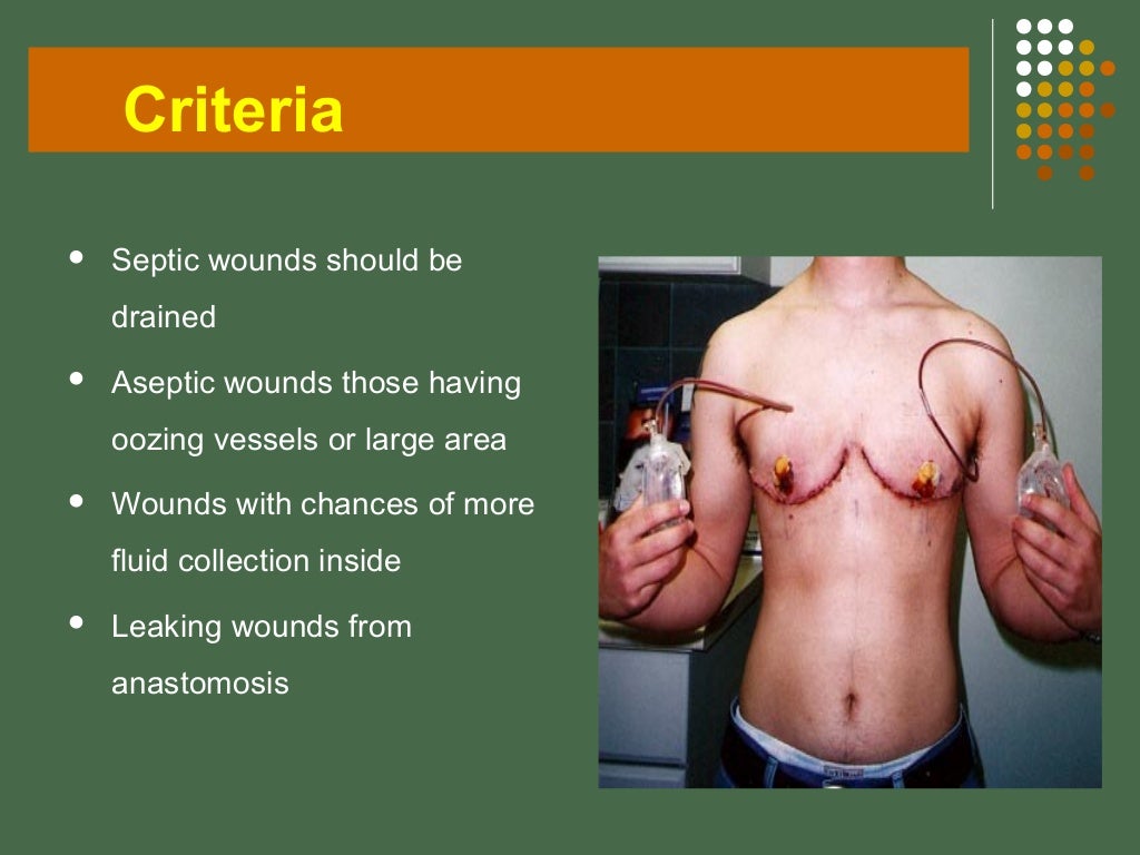Drains in surgery