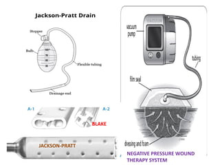 Usage of Various types of Drains in Surgery .pdf