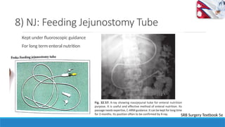 Njft Drains and tubes Used in Surgery, NG Tubes, Foleys Catheter, Chest ...
