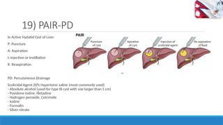 Drains and tubes Used in Surgery, NG Tubes, Foleys Catheter, Chest ...