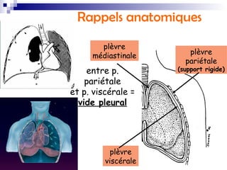 Drainage thoracique | PPT