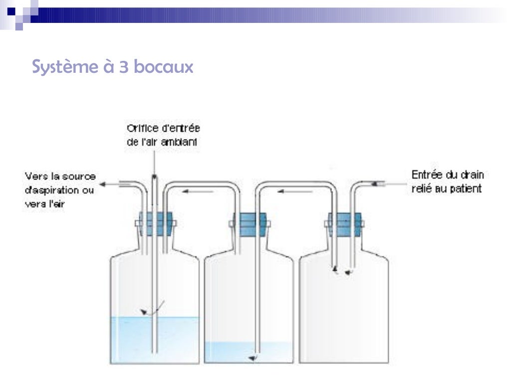 Drain Thoracique En Siphonnage: Drain Thoracique C’Est Quoi – PJYMXM
