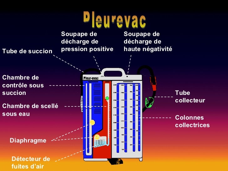 Il Sert De Drain En 5 Lettres