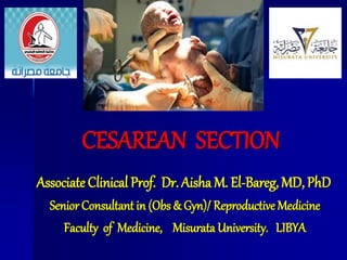 CESAREAN SECTION
Associate Clinical Prof. Dr. Aisha M. El-Bareg, MD, PhD
Senior Consultant in (Obs & Gyn)/ Reproductive Medicine
Faculty of Medicine, Misurata University. LIBYA
 