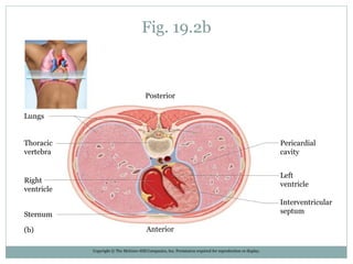 Fig. 19.2b
Copyright © The McGraw-Hill Companies, Inc. Permission required for reproduction or display.
Posterior
Lungs
Pericardial
cavity
Left
ventricle
Interventricular
septum
Anterior
Sternum
Right
ventricle
Thoracic
vertebra
(b)
 