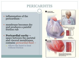 PERICARDITIS
 inflammation of the
pericardium –
 membrane becomes dry
and produces a painful
friction rub
 Pericardial cavity –
space between the parietal
and visceral membranes,
contains pericardial fluid –
 Allows the heart to beat
without friction
 