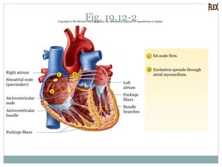 Fig. 19.12-2Copyright © The McGraw-Hill Companies, Inc. Permission required for reproduction or display.
2
1
1
2
2
SA node fires.
Excitation spreads through
atrial myocardium.
Purkinje fibers
Atrioventricular
bundle
Atrioventricular
node
Sinoatrial node
(pacemaker)
Right atrium
Bundle
branches
Left
atrium
Purkinje
fibers
 