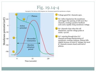 Fig. 19.14-4
0
Voltage-gated Na+ channels open.
Na+ inflow depolarizes the membrane
and triggers the opening of still more Na+
channels, creating a positive feedback
cycle and a rapidly rising membrane voltage.
Na+ channels close when the cell
depolarizes, and the voltage peaks at
nearly +30 mV.
Ca2+ entering through slow Ca2+
channels prolongs depolarization of
membrane, creating a plateau. Plateau falls
slightly because of some K+ leakage, but most
K+ channels remain closed until end of
plateau.
1
2
3
4
1
2
3
4
Membranepotential(mV)
0
+20
–20
–40
–60
–80
Plateau
.30
Time (seconds)
.15
Absolute
refractory
period
Myocardial
contraction
Action
potential
Copyright © The McGraw-Hill Companies, Inc. Permission required for reproduction or display.
 
