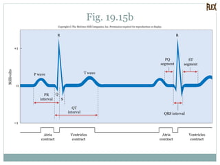 Fig. 19.15b
Copyright © The McGraw-Hill Companies, Inc. Permission required for reproduction or display.
0
Millivolts
R R
Q
S
+1
–1
Atria
contract
Ventricles
contract
Atria
contract
Ventricles
contract
ST
segment
PQ
segment
QRS interval
T waveP wave
PR
interval
QT
interval
 