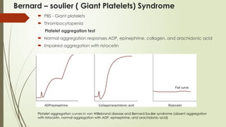 Bernard – soulier ( Giant Platelets) Syndrome
 PBS - Giant platelets
 Thrombocytopenia
Platelet aggregation test
 Normal aggregation responses ADP, epinephrine, collagen, and arachidonic acid
 Impaired aggregation with ristocetin
Platelet aggregation curves in von Willebrand disease and Bernard-Soulier syndrome (absent aggregation
with ristocetin, normal aggregation with ADP, epinephrine, and arachidonic acid)
 