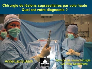 Chirurgie de lésions suprasellaires par voie haute Quel est votre diagnostic ? Anne-Laure Boch Service de neurochirurgie GH Pitié-Salpêtrière 