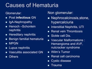 Causes of Hematuria
Glomerular:
◼ Post infectious GN
◼ IgA-Nephropathy
◼ Henoch –Schonlein
nephritis
◼ Hereditary nephritis
◼ Benign familial hematuria
◼ MPGN
◼ Lupus nephritis
◼ Vasculitis associated GN
◼ Others
Non glomerular:
◼ Nephrocalcinosis,stone,
hypercalciuria
◼ Interstitial Nephritis, UTI
◼ Renal vein Thrombosis
◼ Sickle cell Dis.
◼ Vascular Malformations :
Hemangioma and AVF,
nutcracker syndrome
◼ Wilm’s Tumor
◼ Renal cell carcinoma
◼ Cystic disease
◼ Trauma
 
