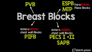 Awake Breast Surgery- Changing Culture | PDF