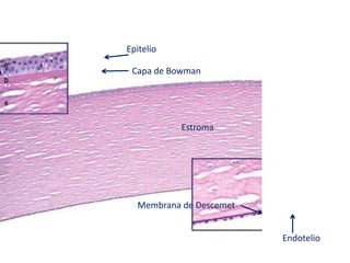 Epitelio
Capa de Bowman
Membrana de Descemet
Endotelio
Estroma
 