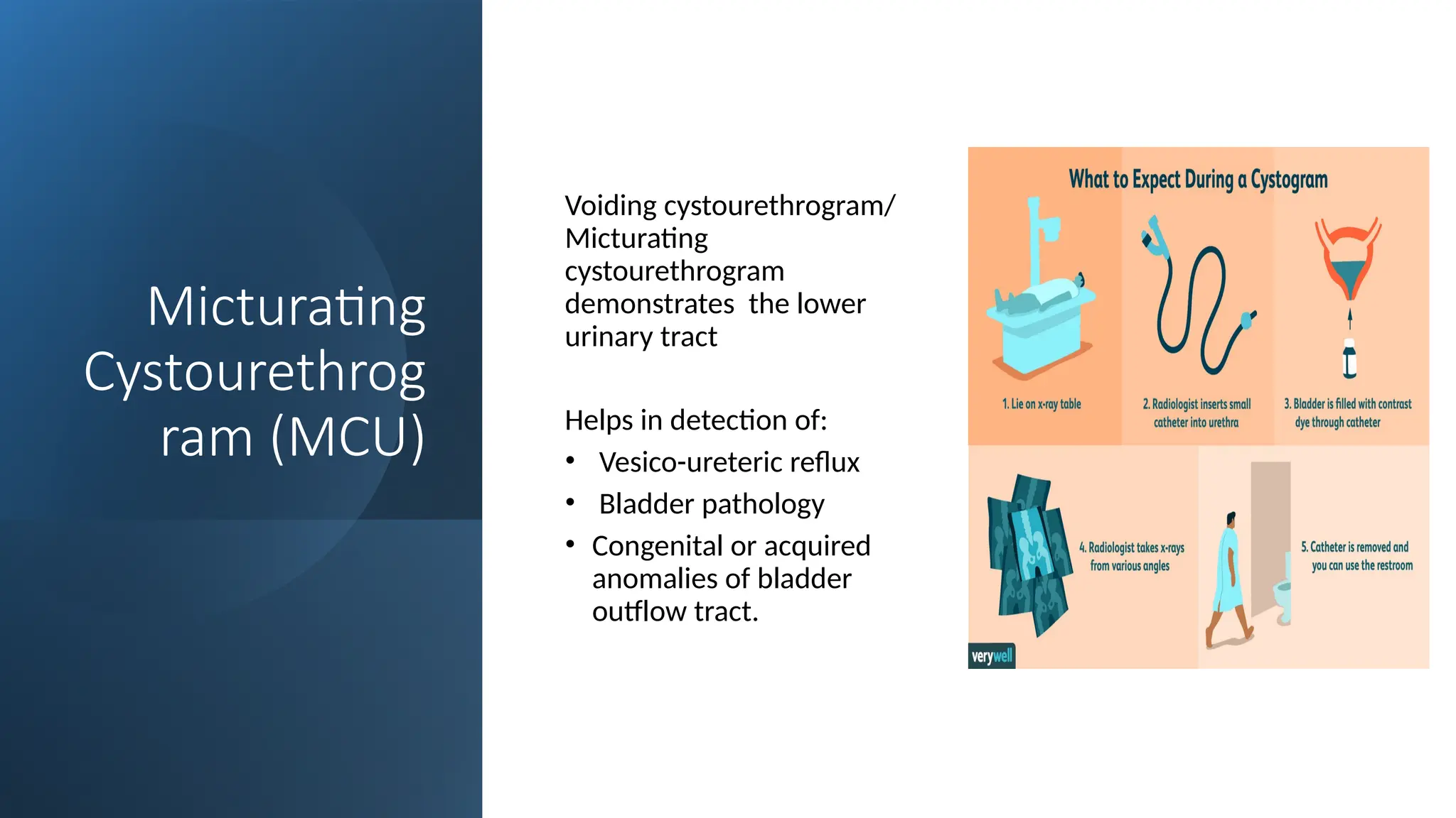Micturating
Cystourethrog
ram (MCU)
Voiding cystourethrogram/
Micturating
cystourethrogram
demonstrates the lower
urinary tract
Helps in detection of:
• Vesico-ureteric reflux
• Bladder pathology
• Congenital or acquired
anomalies of bladder
outflow tract.
 
