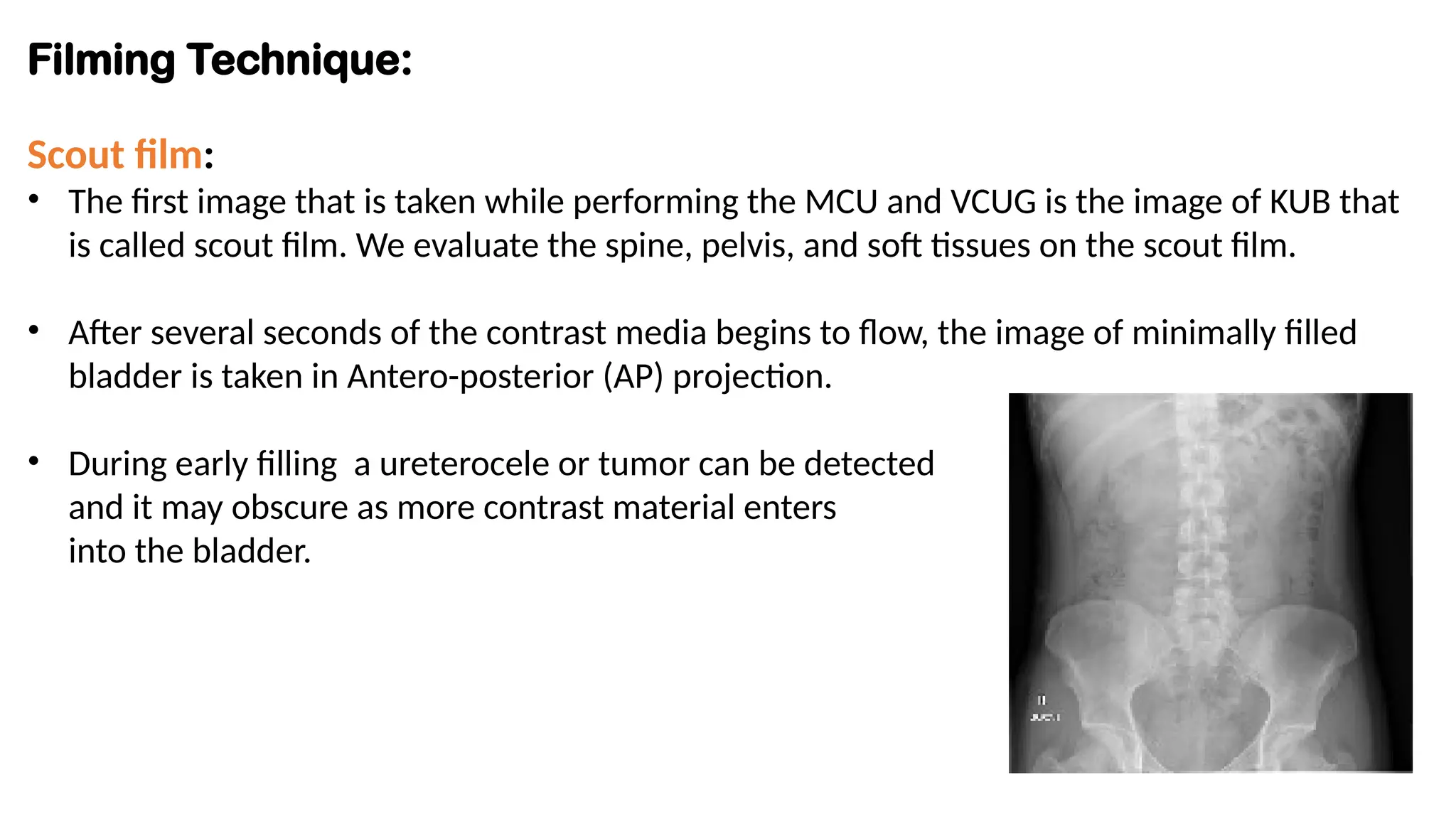 Filming Technique:
Scout film:
• The first image that is taken while performing the MCU and VCUG is the image of KUB that
is called scout film. We evaluate the spine, pelvis, and soft tissues on the scout film.
• After several seconds of the contrast media begins to flow, the image of minimally filled
bladder is taken in Antero-posterior (AP) projection.
• During early filling a ureterocele or tumor can be detected
and it may obscure as more contrast material enters
into the bladder.
 