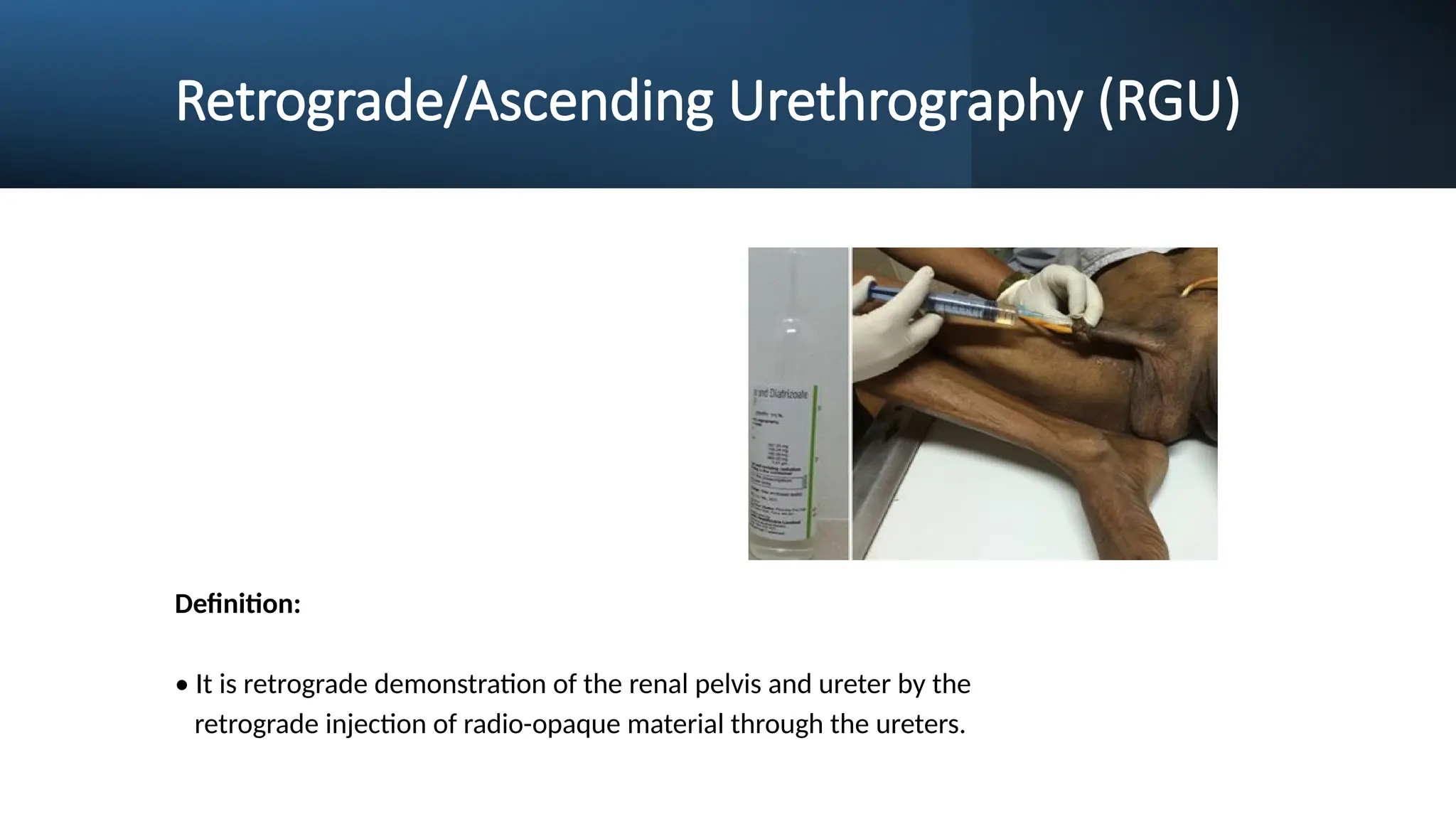 Retrograde/Ascending Urethrography (RGU)
Definition:
• It is retrograde demonstration of the renal pelvis and ureter by the
retrograde injection of radio-opaque material through the ureters.
 