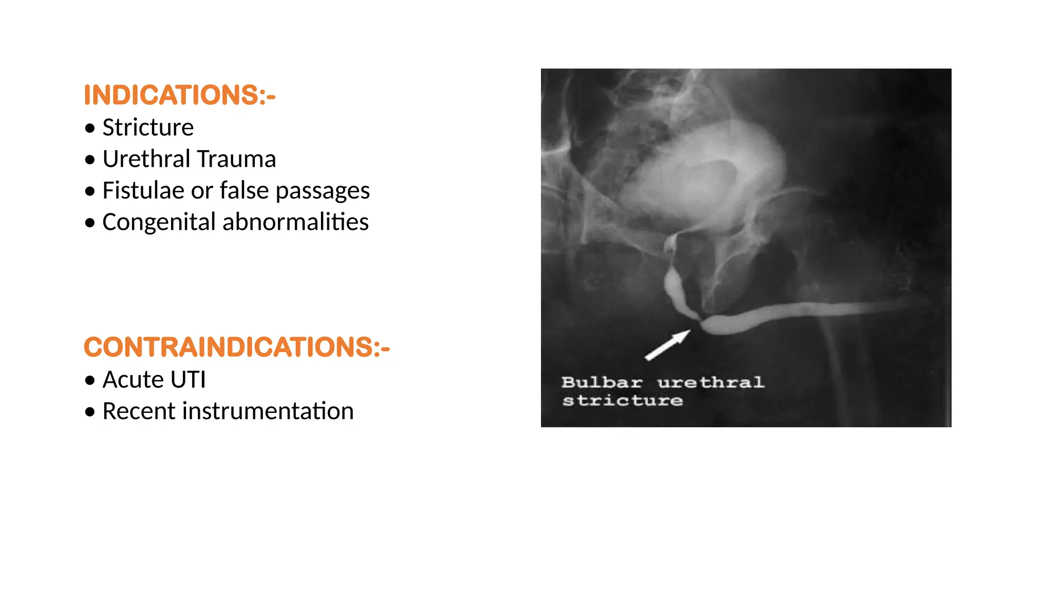 INDICATIONS:-
• Stricture
• Urethral Trauma
• Fistulae or false passages
• Congenital abnormalities
CONTRAINDICATIONS:-
• Acute UTI
• Recent instrumentation
 