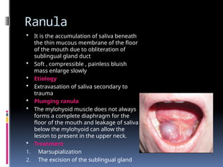 SALIVARY GLAND AND ITS APPLIED ASPECTS.pptx