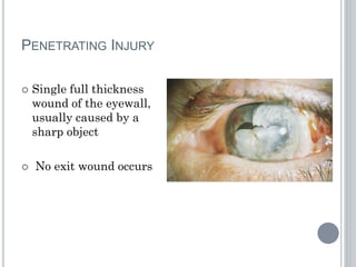 PENETRATING INJURY
 Single full thickness
wound of the eyewall,
usually caused by a
sharp object
 No exit wound occurs
 
