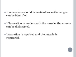  Haemostasis should be meticulous so that edges
can be identified
 If laceration is underneath the muscle, the muscle
can be disinserted.
 Laceration is repaired and the muscle is
resutured.
 