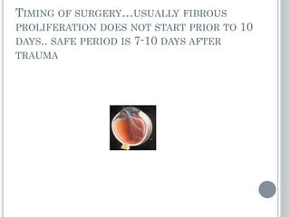 TIMING OF SURGERY…USUALLY FIBROUS
PROLIFERATION DOES NOT START PRIOR TO 10
DAYS.. SAFE PERIOD IS 7-10 DAYS AFTER
TRAUMA
 