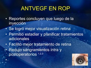 ANTVEGF EN ROP Reportes concluyen que luego de la inyección Se logró mejor visualización retina Permitió estadiar y planificar tratamientos adicionales Facilitó mejor tratamiento de retina Redujo sangramientos intra y postoperatorios  1,2,3 