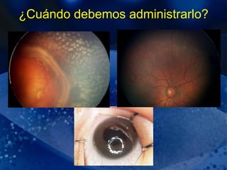 ¿Cuándo debemos administrarlo? 