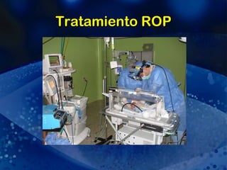 Tratamiento ROP 