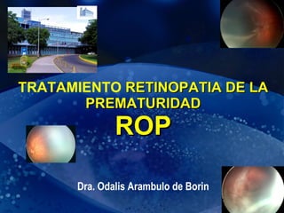 TRATAMIENTO  RETINOPATIA DE LA PREMATURIDAD ROP Dra. Odalis Arambulo de Borin 