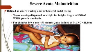 Severe Acute Malnutrition (SAM) and Nutrition Rehabilitation Centre ...