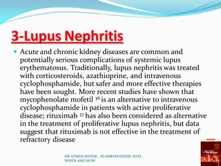 3-Lupus Nephritis
 Acute and chronic kidney diseases are common and
potentially serious complications of systemic lupus
erythematosus. Traditionally, lupus nephritis was treated
with corticosteroids, azathioprine, and intravenous
cyclophosphamide, but safer and more effective therapies
have been sought. More recent studies have shown that
mycophenolate mofetil 36 is an alternative to intravenous
cyclophosphamide in patients with active proliferative
disease; rituximab 37 has also been considered as alternative
in the treatment of proliferative lupus nephritis, but data
suggest that rituximab is not effective in the treatment of
refractory disease
DR AYMAN SEDDIK , PLASMAPHERESIS WHY ,
WHEN AND HOW
 