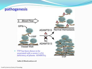 Sadler J E Blood 2008;112:11-18
©2008 by American Society of Hematology
pathogenesis
 TTP has been shown to be
associated with a severe (<5%)
deficiency of plasma ADAMTS13
 