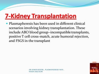 7-Kidney Transplantation
 Plasmapheresis has been used in different clinical
scenarios involving kidney transplantation. These
include ABO blood group–incompatibletransplants,
positiveT cell cross-match, acute humoral rejection,
and FSGS in the transplant
DR AYMAN SEDDIK , PLASMAPHERESIS WHY ,
WHEN AND HOW
 