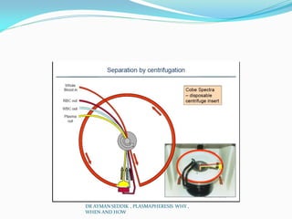 DR AYMAN SEDDIK , PLASMAPHERESIS WHY ,
WHEN AND HOW
 