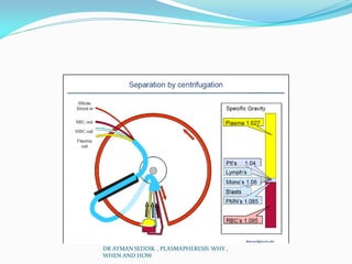 DR AYMAN SEDDIK , PLASMAPHERESIS WHY ,
WHEN AND HOW
 