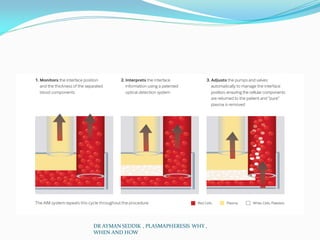 DR AYMAN SEDDIK , PLASMAPHERESIS WHY ,
WHEN AND HOW
 