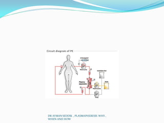 DR AYMAN SEDDIK , PLASMAPHERESIS WHY ,
WHEN AND HOW
 