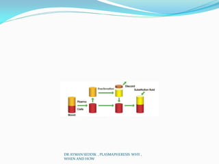 DR AYMAN SEDDIK , PLASMAPHERESIS WHY ,
WHEN AND HOW
 