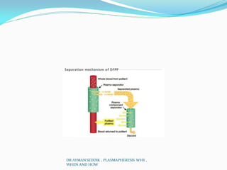 DR AYMAN SEDDIK , PLASMAPHERESIS WHY ,
WHEN AND HOW
 