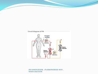 DR AYMAN SEDDIK , PLASMAPHERESIS WHY ,
WHEN AND HOW
 