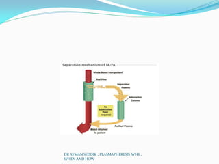 DR AYMAN SEDDIK , PLASMAPHERESIS WHY ,
WHEN AND HOW
 