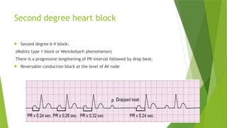 ECG PPT POWER point presentation cardiology | PPTX